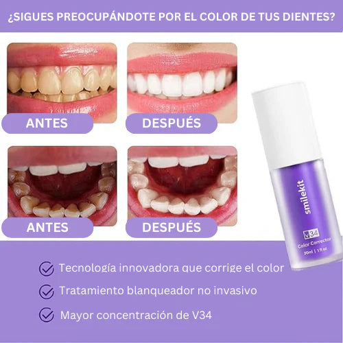 Smilekit Espuma Morada Blanqueadora